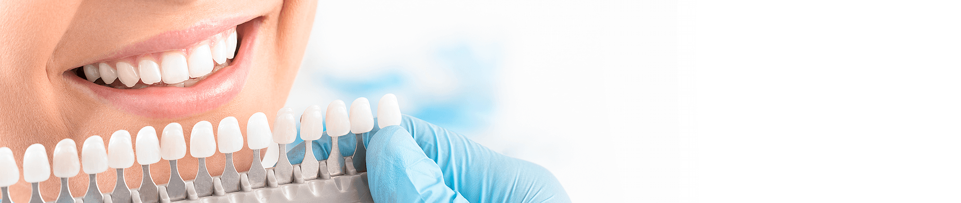 Veneers in San Luis Obispo, California